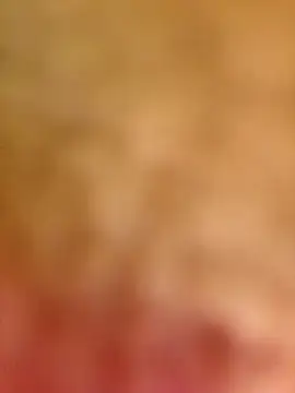 Enferma Sexual05 online show from 9, 3, 2025