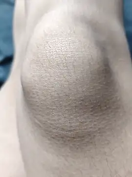 Miky Lyn online show from 18, 2, 2026